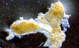 celulascerdoinsulina