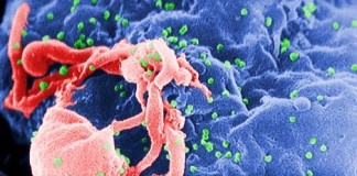 hiv