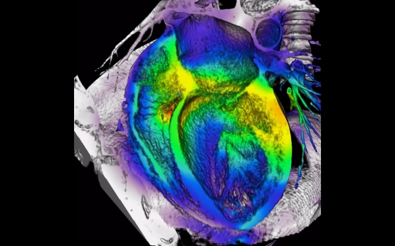 enfermedad arterial