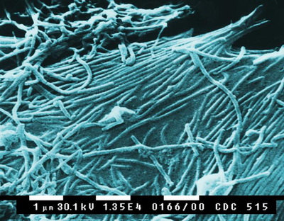 ebola virus