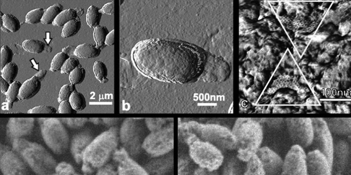 Clostridium-novyi