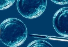 Ictus: pacientes capaces de caminar de nuevo después de un trasplante de células madre
