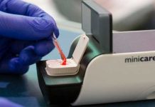 Dispositivo de mano detecta ataques al corazón con una gota de sangre
