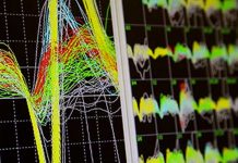 Interfaz ayuda a recuperar la sensibilidad y control muscular en pacientes con parálisis