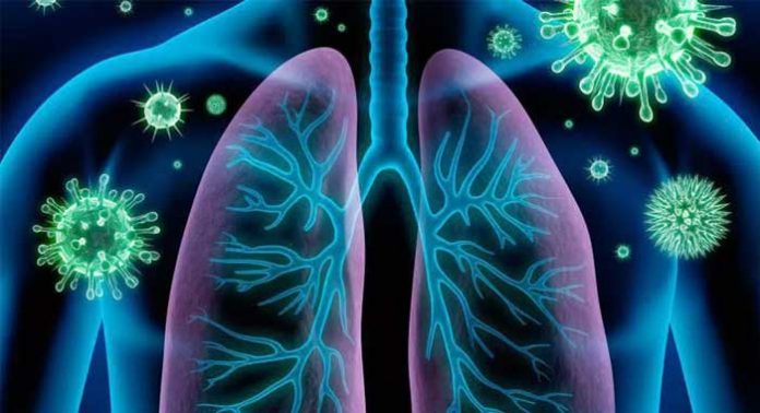 bronquitis