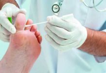 Infecciones por hongos: Tipos y tratamiento